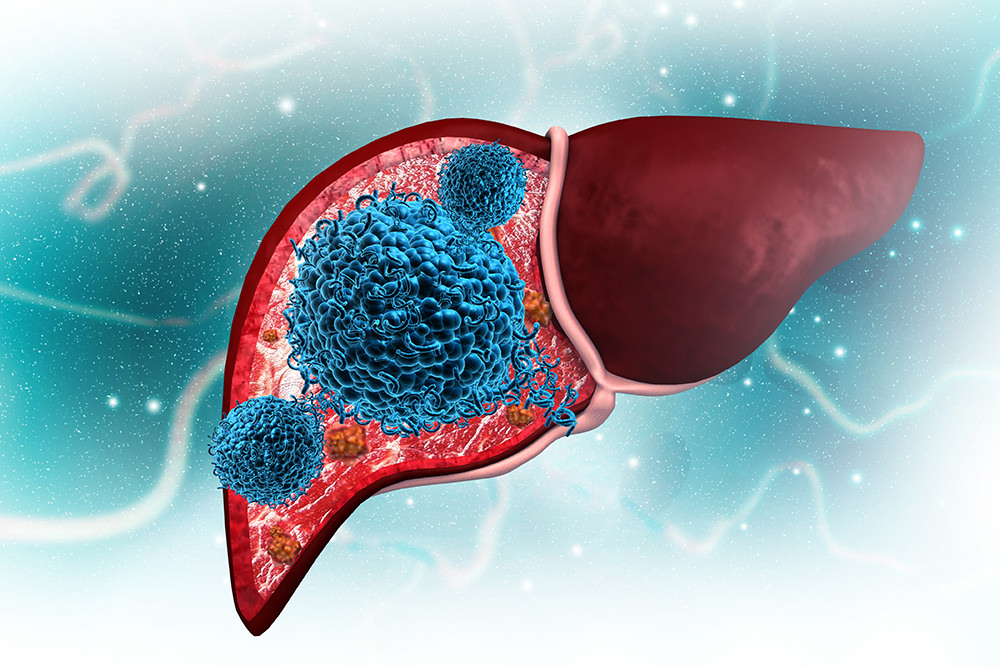 family-doctor-and-infectiologist-luebeck-hepatitis-c